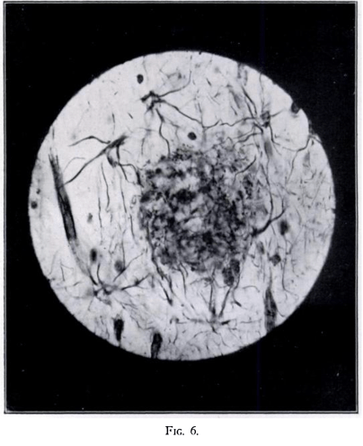 Lire la suite à propos de l’article Jeudi 5 juin : Les hybrides gérontopathologiques par Robin Michalon